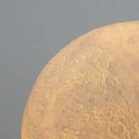ATAQUE DE CASPA. Sol